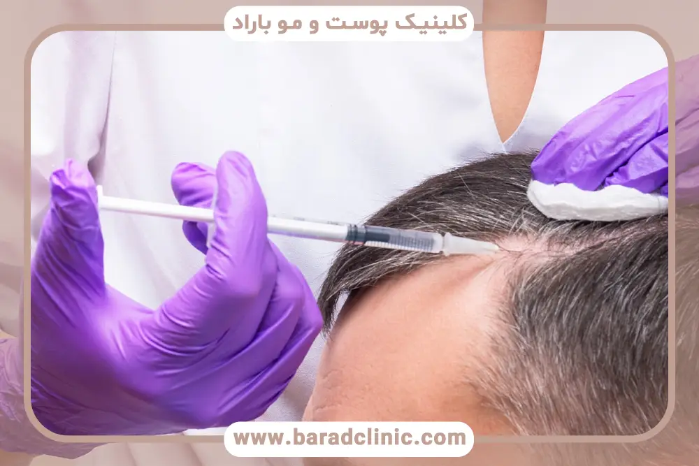 ویژگی‌های بهترین مرکز پی آر پی (prp) مو در تهران 