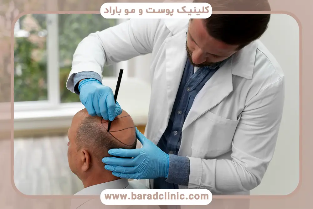 فرایند کاشت مو قسطی بدون چک 
