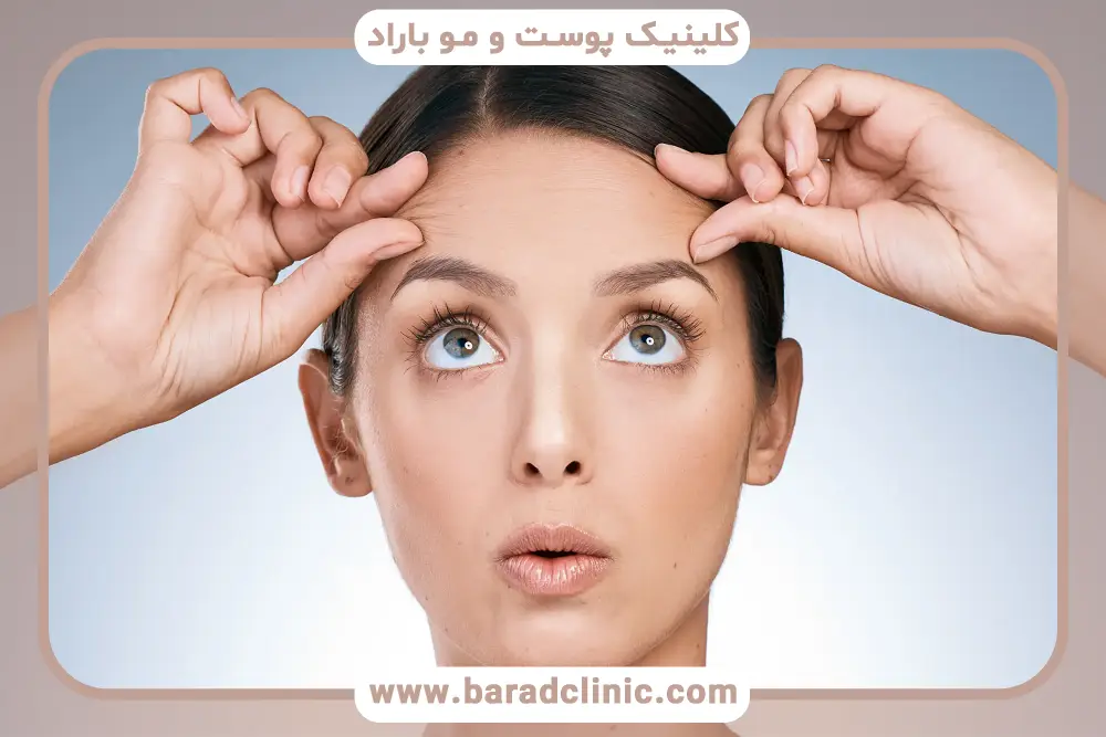 بررسی تفاوت بلفاروپلاستی و لیفت ابرو  