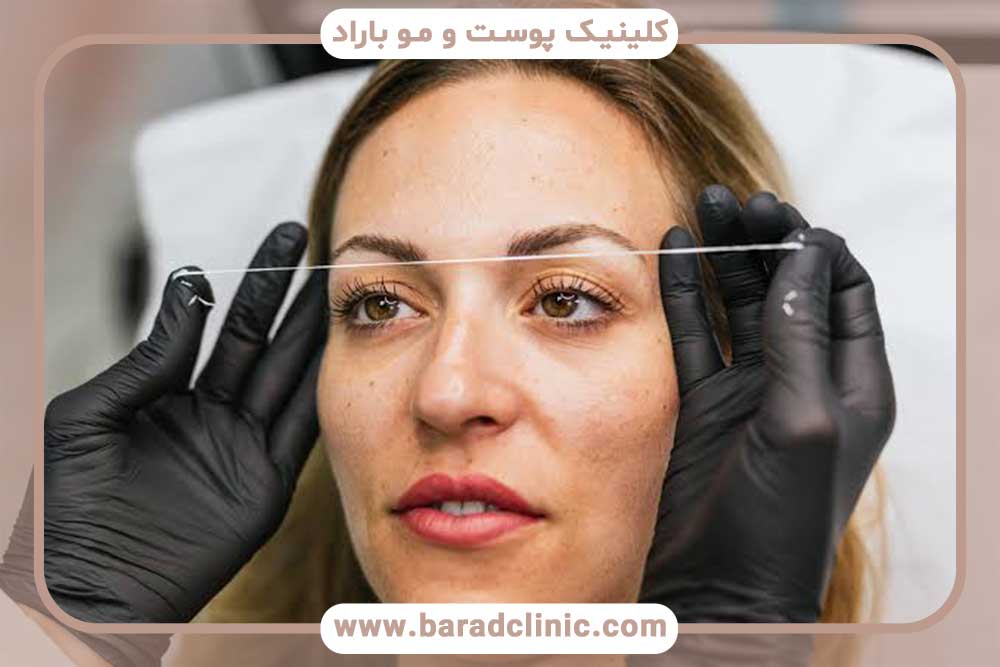 متخصص کاشت ابرو