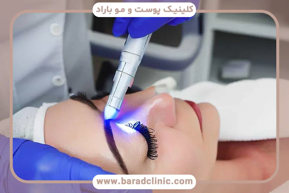 بررسی هزینه پلاژن تراپی صورت