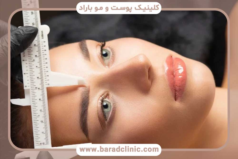 مرکز کاشت ابرو