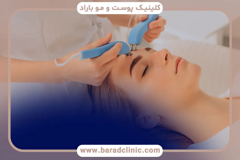 نحوه اثرگذاری بوتاکس صورت
