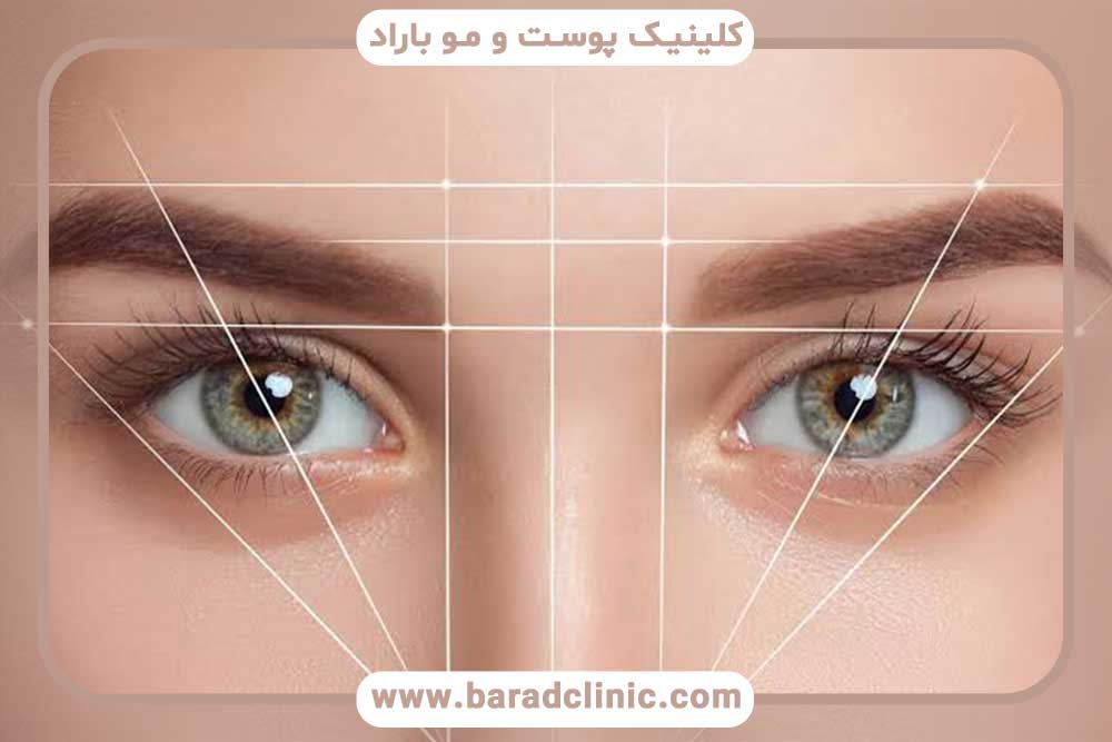 مراقبت‌های کاشت ابرو