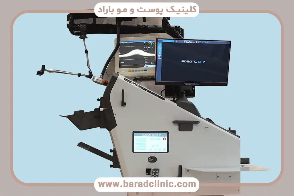 آشنایی با روش جدید کاشت مو با دستگاه