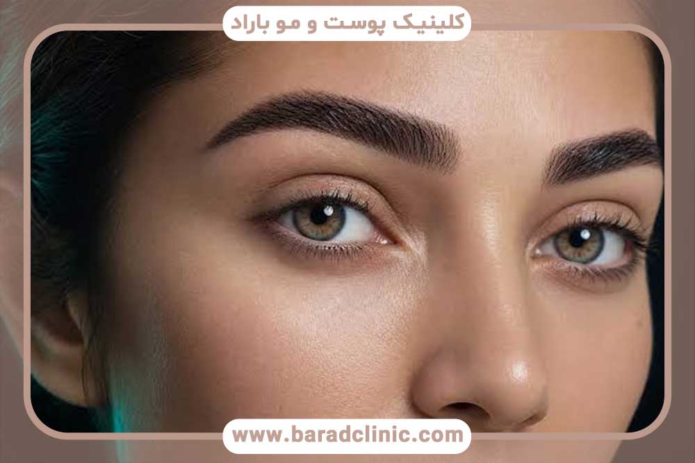 سوالات کاشت ابرو