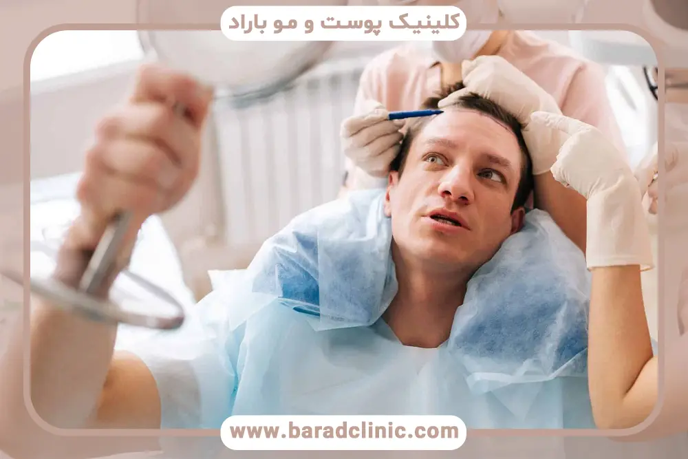 کاندیدای مناسب روش کاشت موی MIA 