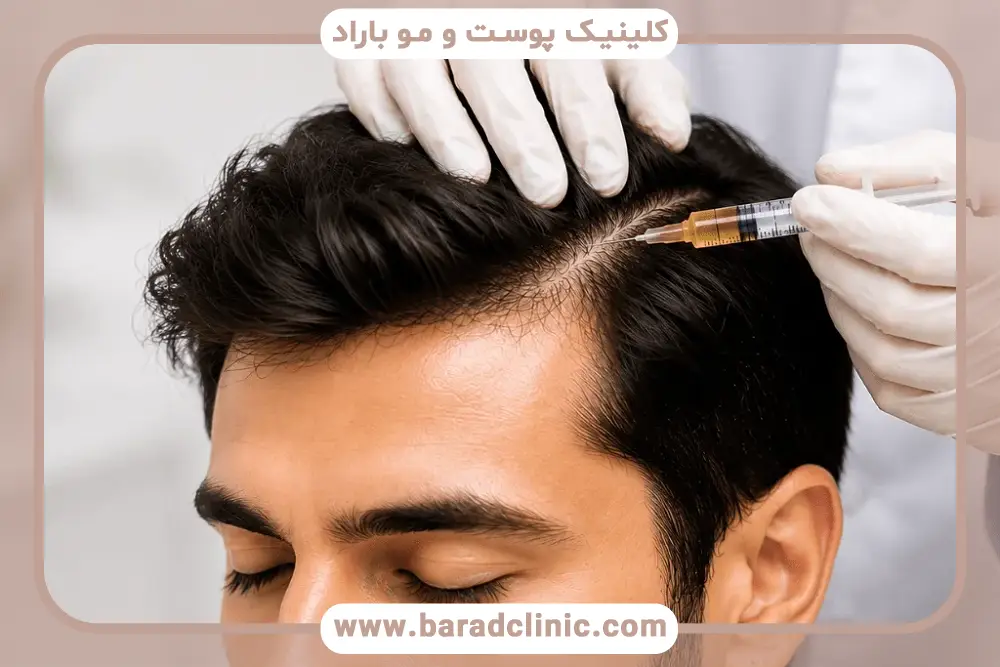 بررسی تخصص بهترین دکتر  پی آر پی (prp) مو 