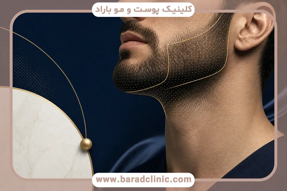 سلامت پوست کاندیدای کاشت ریش 