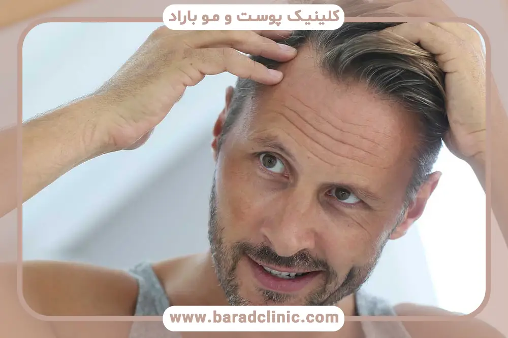 تاثیر فرم پیشانی روی فاصله استاندارد خط رویش مو تا ابرو 