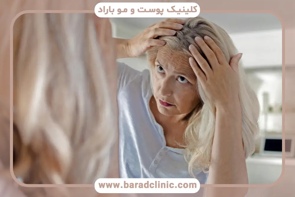 علائم کمبود فریتین و ریزش مو