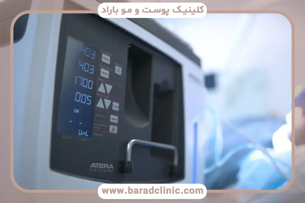 فرایند روش جدید کاشت مو با دستگاه