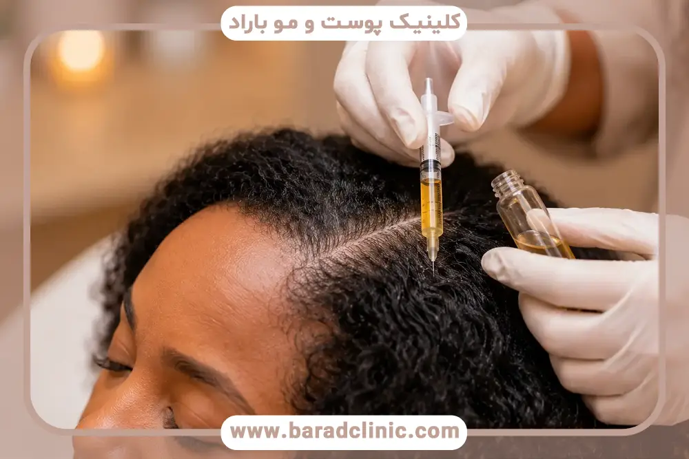 جلسه مشاوره بهترین مرکز پی آر پی (prp) مو در تهران 