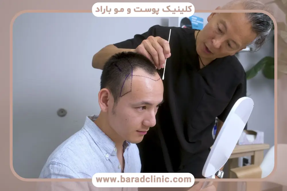 ملاحظات دارویی کاشت مو در بیماران ام اس 
