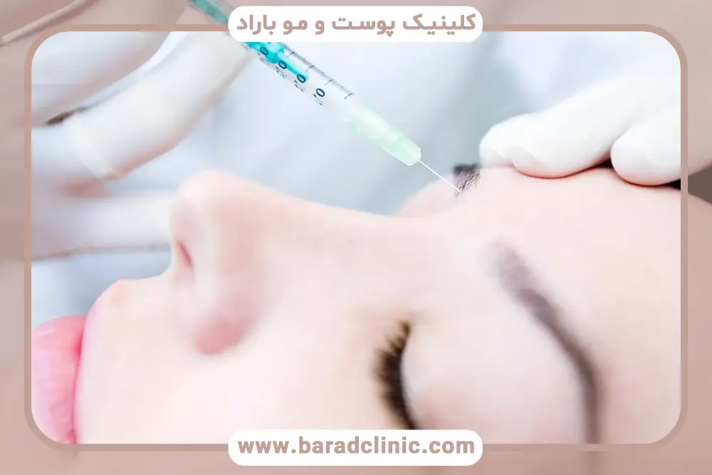 تعداد جلسات پی ار پی بعد از کاشت ابرو 