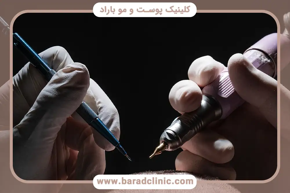 کلینیک باراد بهترین مرکز کاشت مو در شمال تهران بلوار کاوه